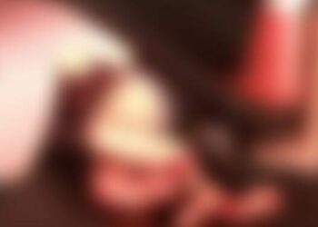 Vídeo: carro em alta velocidade atropela e esmaga perna de mulher em Manaus