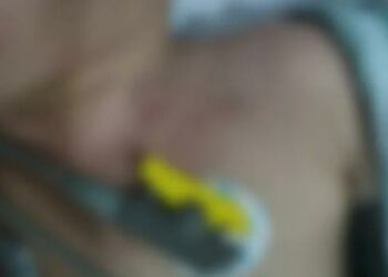 Casal é preso por espancar menino de 1 ano e deslocar sua clavícula