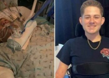 Rapaz sobrevive ao ter metade do corpo amputado após ter sido atingido por uma empilhadeira