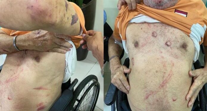 Idoso de 84 anos é brutalmente espancado durante assalto em Manaus