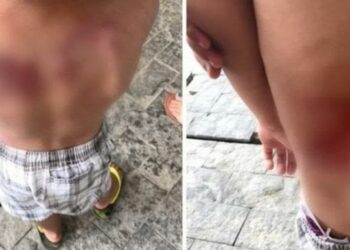 Menino de 5 anos é brutalmente espancado pela mãe após fazer xixi nas calças