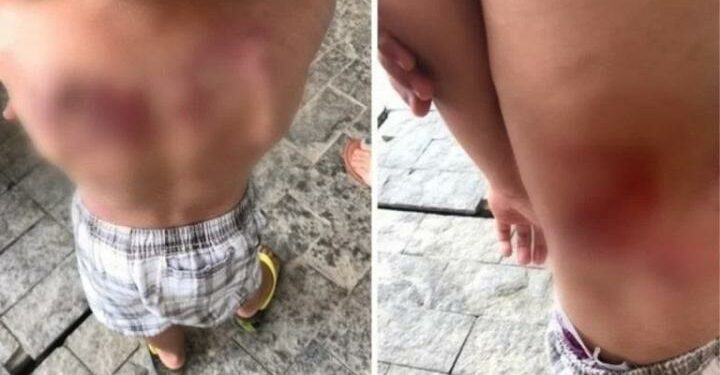 Menino de 5 anos é brutalmente espancado pela mãe após fazer xixi nas calças