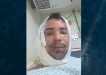 Durante discussão, homem joga gasolina e ateia fogo em amigo