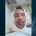 Durante discussão, homem joga gasolina e ateia fogo em amigo