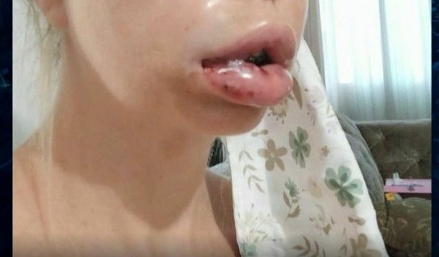 Dentista é acusada de deformar rosto de 18 pacientes