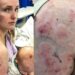 Mãe usa o próprio corpo para proteger bebê de tempestade de granizo