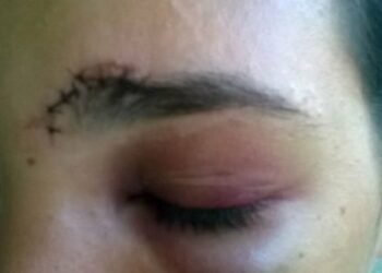 Casal é preso após torturar jovem, cortar cabelos e abandonar a vítima nua em via pública