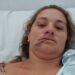 Mulher precisa de reconstituição da gengiva após ser brutalmente espancada pelo ex-companheiro