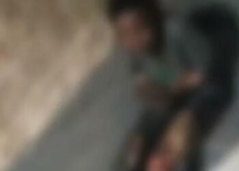 Vídeo: mulher é estuprada e tem 40% do corpo queimado após perder nota de R$ 5