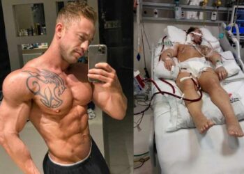 Fisiculturista que venceu a covid-19 após 62 dias em UTI desabafa: ‘não subestimem essa doença’