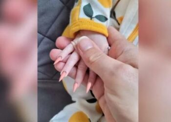 Fotos de bebê com unhas ‘stiletto’ viralizam e geram revolta na web: “Mãe irresponsável”