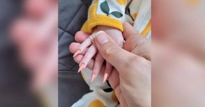 Fotos de bebê com unhas ‘stiletto’ viralizam e geram revolta na web: “Mãe irresponsável”