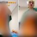 Médica-cirurgiã é suspensa após compartilhar vídeos com pele de pacientes: “troféu de hoje”