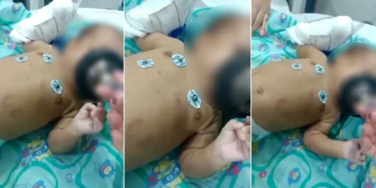 Bebê perde rim ao ser espancado pelo próprio pai por causa de choro excessivo
