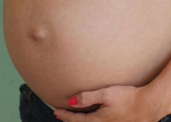 Grávida de 8 meses perde bebê e culpa ‘Kit Covid’: “Minha filha não mexeu mais”