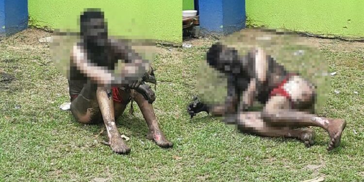 Homem leva descarga elétrica ao tentar roubar fiação em Manaus
