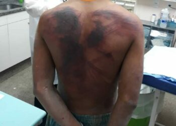 Pai fica cego após ser agredido pelo filho com golpes de terçado em Manaus