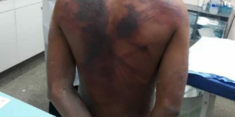 Pai fica cego após ser agredido pelo filho com golpes de terçado em Manaus