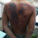 Pai fica cego após ser agredido pelo filho com golpes de terçado em Manaus