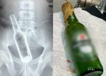 Após bebedeira, jovem enfia garrafa de cerveja no ânus e vai parar no pronto-socorro