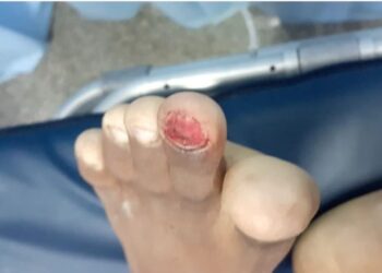 Adolescente é torturado e morto após dívida com traficante em Manaus