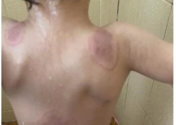 Mulher é presa por suspeita de torturar filho de 3 anos; criança foi encontrada desnutrida