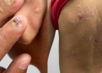 Homem é preso por torturar filho de 8 anos com alicate e fios elétricos