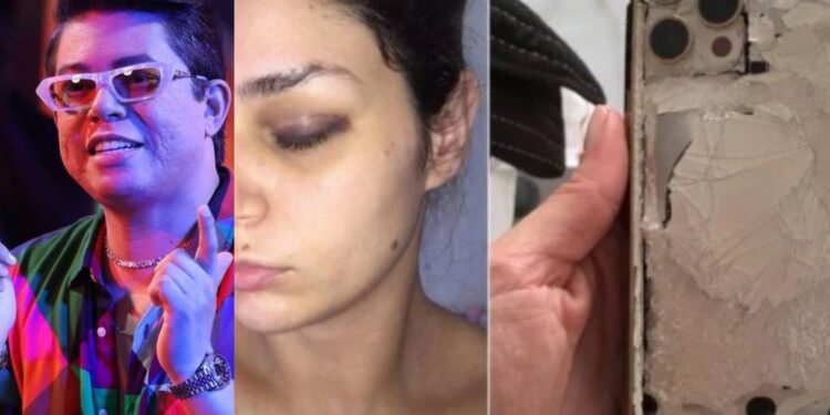 DJ Ivis agride brutalmente esposa, mas consegue se livrar do flagrante