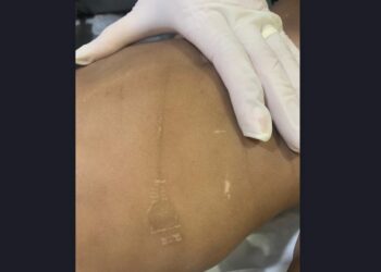 Pais são presos por torturar, estuprar e matar bebê de 1 ano