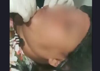 Pelo menos 20 mulheres que tiveram corpo deformado denunciam falsa médica em Manaus