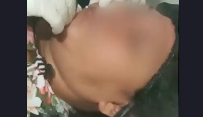 Pelo menos 20 mulheres que tiveram corpo deformado denunciam falsa médica em Manaus