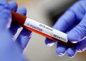 Covid-19: Brasil tem 19 milhões de casos acumulados e 533,4 mil mortes