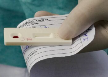 Amazonas registra 509 novos casos de Covid-19 em 24h