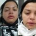 Faxineira atacada com ácido por ex-patrão teme perder a visão