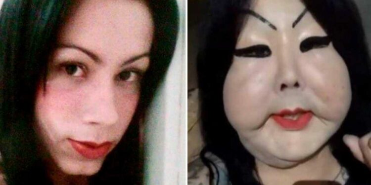 Juju Fofão revela que caiu no golpe do silicone: “encheram a minha cara de laxante’