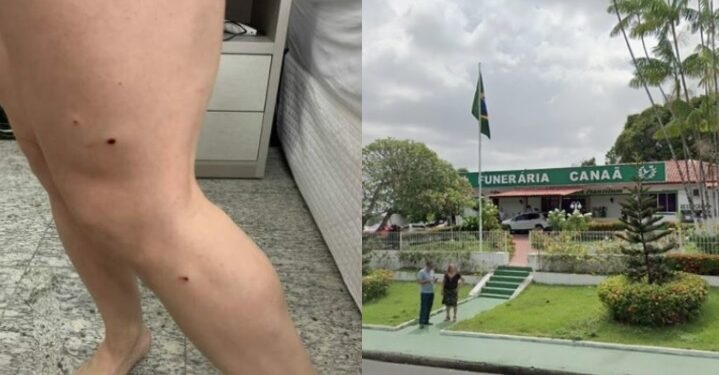 PC pede à Justiça prisão de dono de funerária suspeito de atirar em sócia, em Manaus