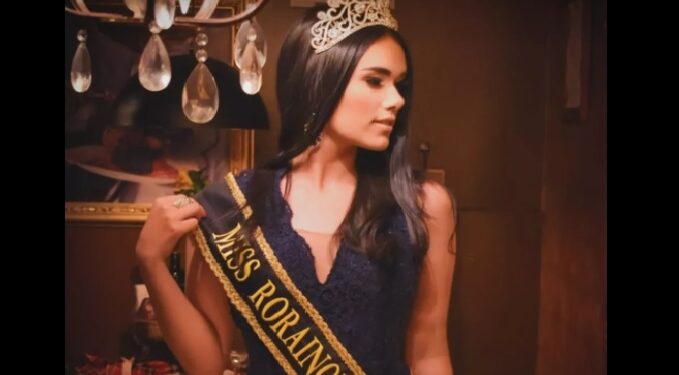 Miss Roraima morre durante cirurgia de urgência