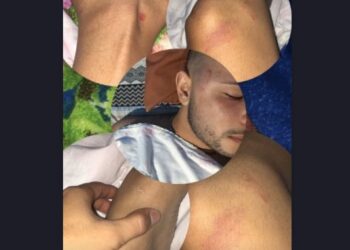 Cliente fica desacordado após ser agredido por seguranças do Sun Paradise