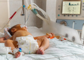 Bebê de 9 meses é baleado no colo do pai durante tentativa de homicídio, no Educandos