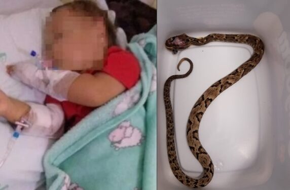Bebê de 1 ano é picado por cobra enquanto brincava no quintal de casa