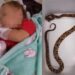 Bebê de 1 ano é picado por cobra enquanto brincava no quintal de casa