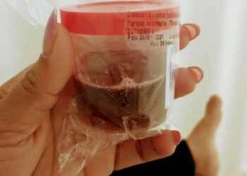 Rabdomiólise: Amazonas já registra 55 casos da ‘doença da urina preta’