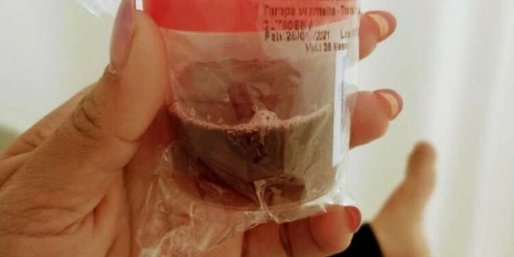 Rabdomiólise: Amazonas já registra 55 casos da ‘doença da urina preta’