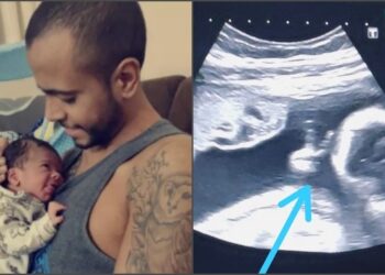 Após luta contra câncer, pai de bebê que fez ‘V de vitória’ durante ultrassom, morre em SP