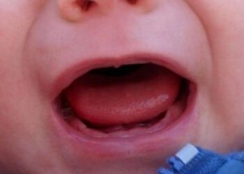 Revoltante: Mãe é presa por torturar filha de 1 ano e 2 meses