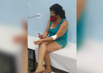 Manicure arranca dedo de cliente com os dentes por ela não pagar por serviço; imagem forte