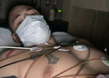 Ex-UFC internado com covid nega ser antivacina e diz que não foi imunizado porque ‘espera o melhor chegar’