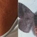 Mariposas causam surto de coceira e lesões em pele de moradores de Recife