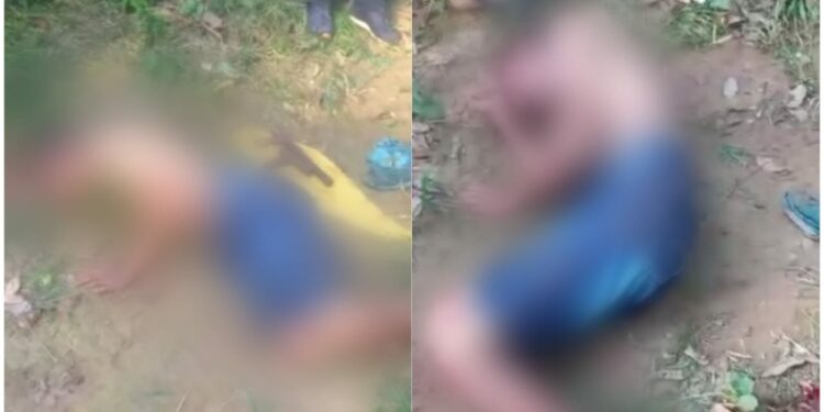 Adolescente tem pé decepado pela população após cometer roubos em Manacapuru