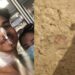 Jovem dorme em praia e acorda com barriga aberta e parte do intestino para fora do corpo